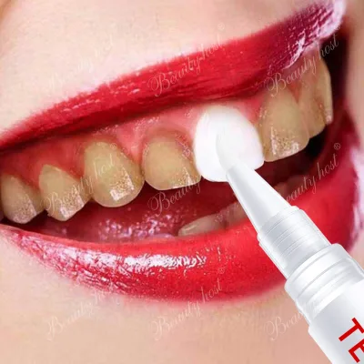 Professional Fast Brighten Teeth Whitening Pen Safe Effective Bleaching Stains Removal Portable Deodorant Shinning Dental Care