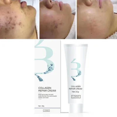 Collagen Face Cream Firming Sensitive Skin and Hormone Face Collagen Face Cream Recombinant Human Collagen Repair Cream