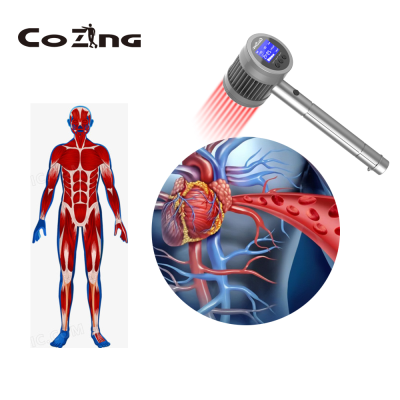 Cold Laser Treatment Device Alternative Medicine for Rheumatoid Arthritis