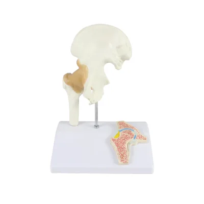 Hip Joint With Ligament and Saggital Section