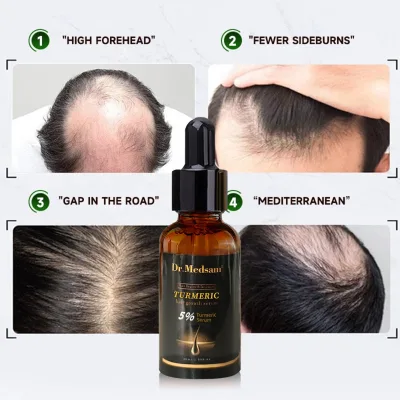 Anti Hair Loss Serum,Turmeric Oil Hair Regrowth Care 5% Hair Growth Serum Oil