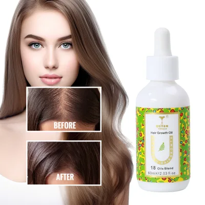 Wholesale Anti Hair Loss Organic Strengthening Repair Hair Treatment Extract Hair Growth Oil