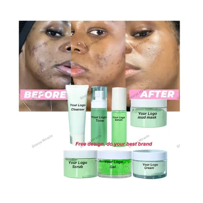 OEM Private Label Rejuvenating Brighter Healthier Skin Oil Control Shrink Pores Anti Acne Pimple Good Reviews Facial Care Set