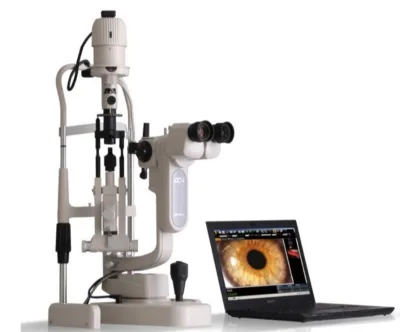 Topcon SL-D301Slit Lamp: Advanced Features and Reliable Performance for Eye Care Professionals