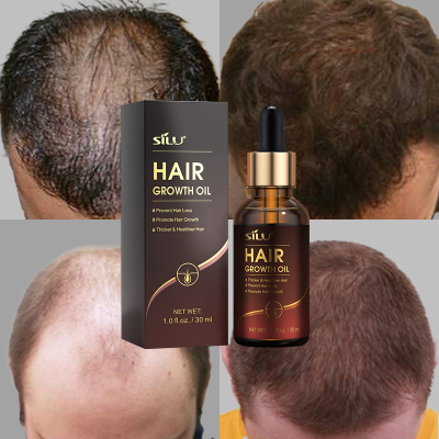 Ginger Hair Growing Hairline Video Human Stem Cell Hair Grow Serum Aoxue for African Hair Grow
