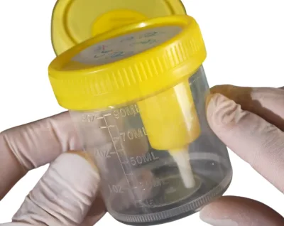 Sterile Stackable Plastic Vacuum Urine Container Needle 30ml/60ml/120ml Space-Saving Screw Lid Design Visible Scale Markings