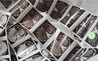 Ultrasound Paper Rolls 110HG Made in China for for Devices UP-X898MD/895/D895/D897/895MD/897MD Glossy Print Media 110HG