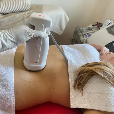 Factory Price Home Use Portable Body Fat Removal High Intensity Focus Fat Burning Melt Device Melt Fat Machine Burn Fat Machine