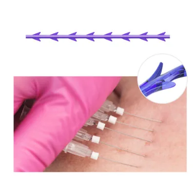 Best selling face lifting v tightening cones cog pdo threads