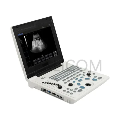 Cheapest Portable Cardiac Gynecology Ultrasound Scanner Ultrasound Machine Desktop B Ultrasound Price