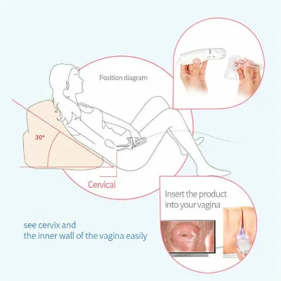 Factory Supply Portable Digital Colposcope Mini Colposcope Gynecology Examination Equipment