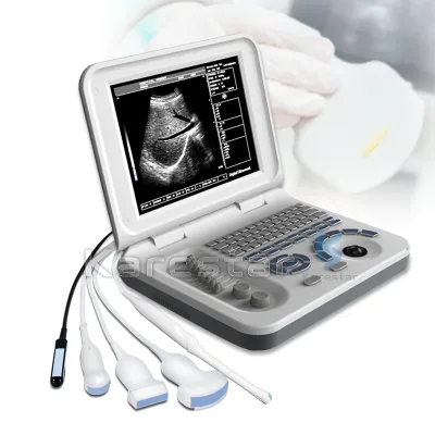 Katrestar K-H200 Factory Wholesale Medical UItrasound Devices Digital Laptop Second Hand Ultrasound Machine