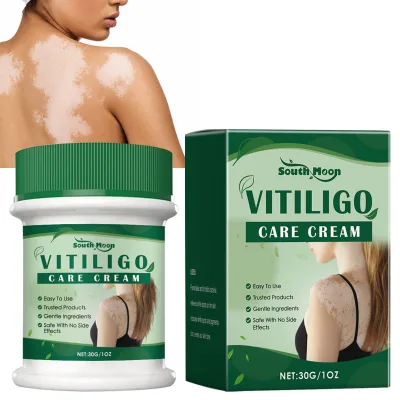 30g Herbal Extract Vitiligo Ointment Remove Ringworm White Spot Removal Skin White Spot Leukoplakia Disease Treatment Cream