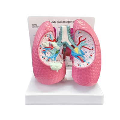 Anatomy of Smoking Lung, Healthy Lung, Breathing Lung and Bronchial AIDS, a Comparative Model of Human Visceral Respiration