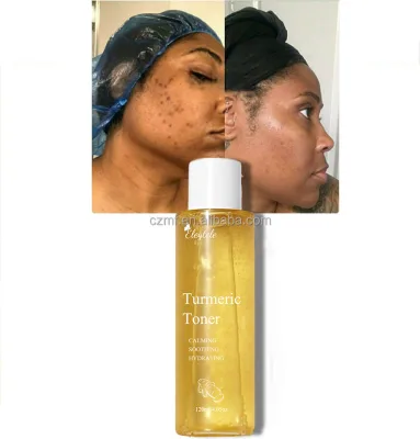 Private Label Turmeric Strong Lightening Facial Toner Moisturizing Whitening Salicylic Acid Acne Treatment Turmeric Face Toner