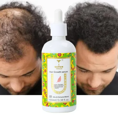 Hair Growth Serum for Thick Hair Fast Growth Hair Loss Treatment Oil Oem Service High Quality 100Ml