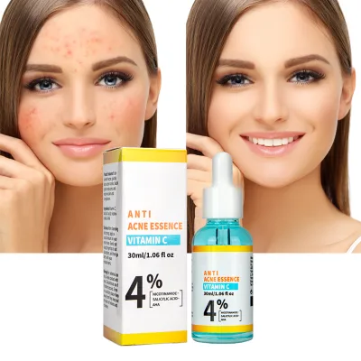 Dermatological Glycolic Salicylic Acid Anti-Acne Whitening Facial Treatment with Vitamin C & Apple Stem Cell 30ml Liquid