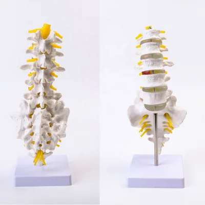 Scientific Lumbar Spine Model with 5 Vertebrae, Life Size Human Lumbar Vertebrae Anatomy Model with Sacrum, Spinal Disc