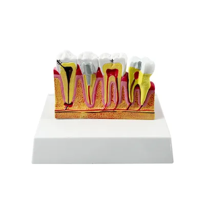 Medical teaching tooth model tooth demonstration model tooth anatomy nerve distribution