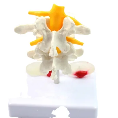 4 stage lumbar vertebrae degeneration model Human spine model