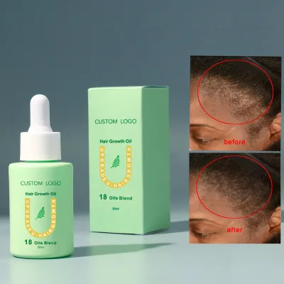 OEM Herbal Tea Tree Hair Elixir Growth Oil Rosemary Mint Scalp Strengthening Hair Fall and Hair Growth Treatment Oil Bulk