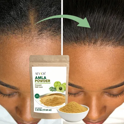 Pure Amla Extract Powder Ayurvedic Hair Care Products Deep Conditioning Hair Mask Powder Repair Treatment Powder to Growth Hair
