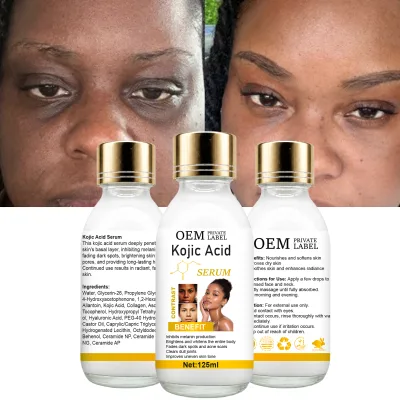 2026 New Design Kojic Acid Brightening Face Serum 125ml Deep Exfoliation Antioxidant Skin Care OEM ODM