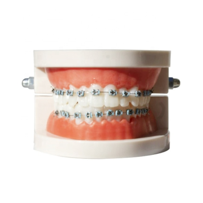 Good Quality Popular Dental Orthodontic Model Medical Teaching Study