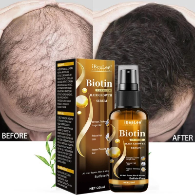 Hair Treatment Solution Nourishes and Prevents Hair Loss, Moisturizes Hair Roots, Thickens Hair, and Provides Scalp Massage.