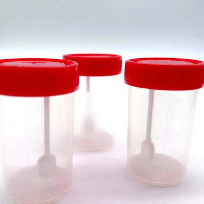 PP Stool Specimen Container 30/60ml CE Certified Class I Medical Device