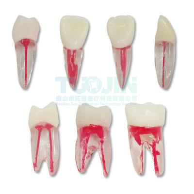 Dental Root Ca Nal Teeth Model Orthodontic Endodontic Teeth Dental Endodontic Rotary Files Typodont Teeth Dentistry Materials