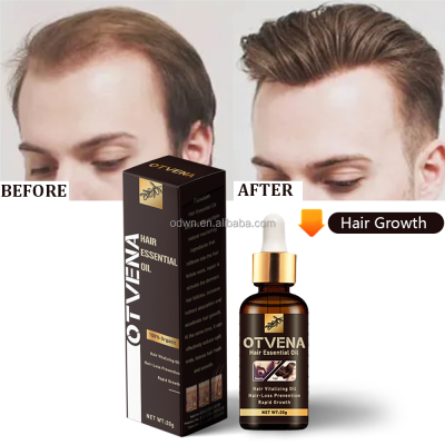 Hair Care Oil with Multiple Nourishing Ingredients for Split End Reduction 20ml