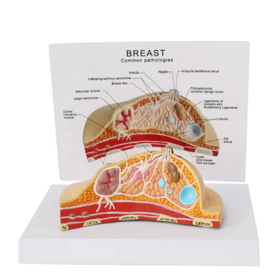 Female Breast Cancer Model School Teaching Aids Gynecology Doctors Breast Cross Section PVC Breast Anatomical Model