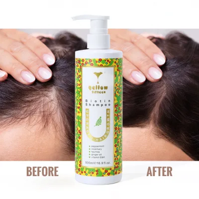 Coconut Black Jamaican Castor Oil Ginger Scalp Oil Organic Natural for Hair Growth Original