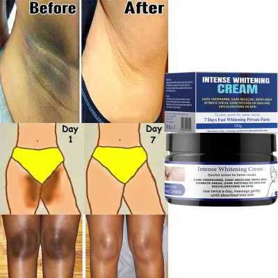 Whitening Cream for Body Brightens and Rejuvenates Skin 100g Female Use