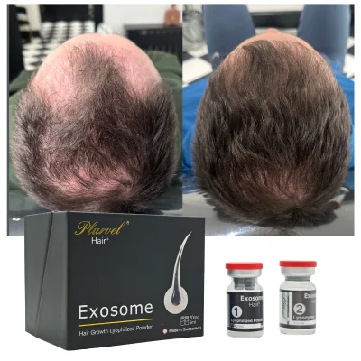 Hair Regrowth Exosome Kit 20mg Lyophilized Powder 5ml Activator for Scalp Therapy