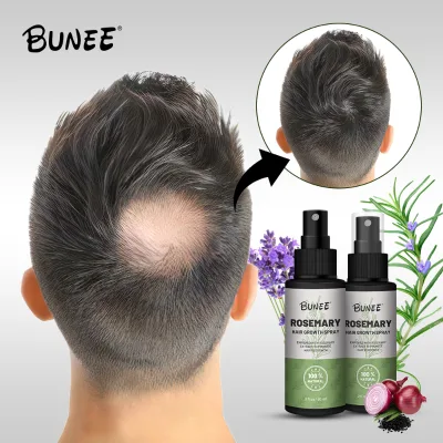 Hot Sale Rosemary Hair Growth Liquid Spray Hair Loss Treatments Eaasential Oil Serum Hair Regrowth Tonics