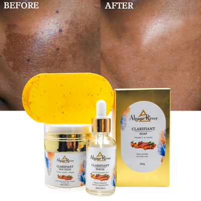 Private Label Wholesale SkinCare Products Natural Organic Vitamin C Face Dark Spot Removal Skin Brightening Snail Skin Care Set