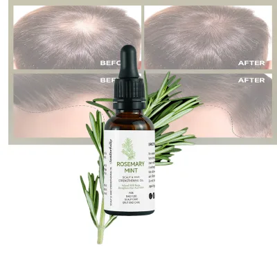 Vegan Rosemary Serum for Hair Loss Rosemary Mint Tea Tree Oil for Fast Hair Growth Vitamin E Oil Treatment Hair
