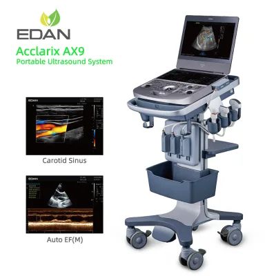 Edan Acclarix AX9 Mobile Ultrasound Machine with High Resolution Display Built-in Battery and Intelligent Tools