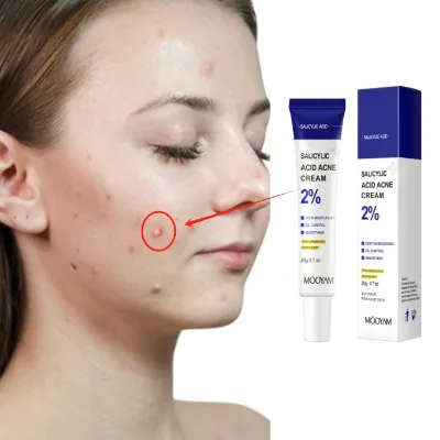 Fast Effective Salicylic Acid Acne Removal Facial Cream Smoothing Moisturizing Herbal Natural SkinCare Acne Face Cream