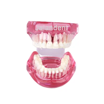 Hot Popular Orthodontic Demonstration Teeth Model With Ceramic Bracket Dental Teach Tooth Model Dental Decoration