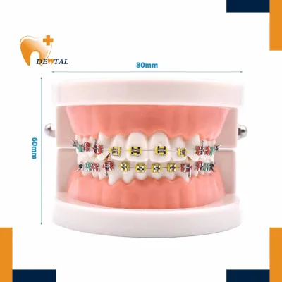 Dental Demonstration Orthodontic Standard Teeth Model Manual Power Highly Simulated Oral Mold Featuring Metal Brackets Wires