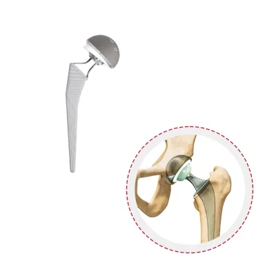 High Quality Titanium Alloy Cementless Hip Prosthesis Instrument Set Femoral Stem Hip Implants Interventional Materials
