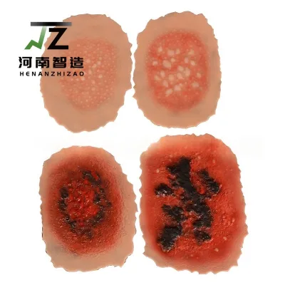 Stick-on Burn Skin Model, Skin Wound Model & Doctor-Patient Explanation Model for Teaching Models (Level 1-4)