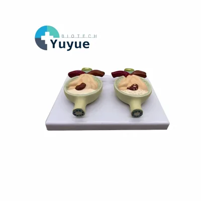 Human Pathological Bladder Model for Proteinuria Comparative Anatomical Teaching Display Model for Biology Lab Education