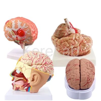 Medical Education Model Human Brain With Arteries and Nerves