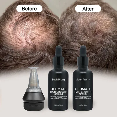 Private Label Pdrn Regenerating Hair Care System Fast Hair Growth Serum Scalp Applicator Hair Growth System