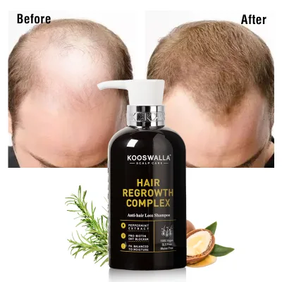 High Quality 100% Natural Organic Anti-Hair Loss Hair Regrowth Essence Shampoo OEM Formula Cream