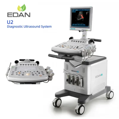 Edan U2 Color Doppler Ultrasound Machine with Compact Design and High Resolution Display for Mobile Diagnosis